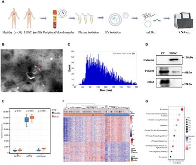 Plasma extracellular vesicle long RNA profiling identifies a predictive signature for immunochemotherapy efficacy in lung squamous cell carcinoma